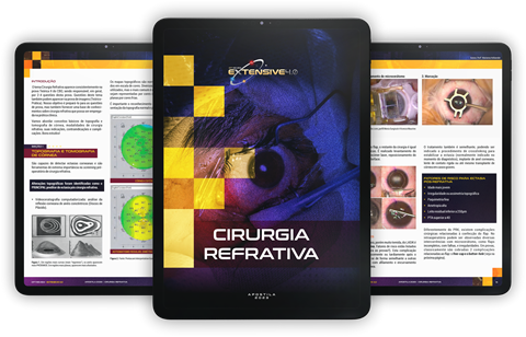 imagem apostila catarata