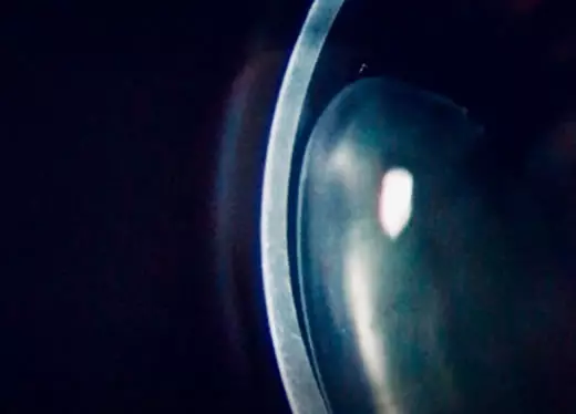 banner módulo catarata