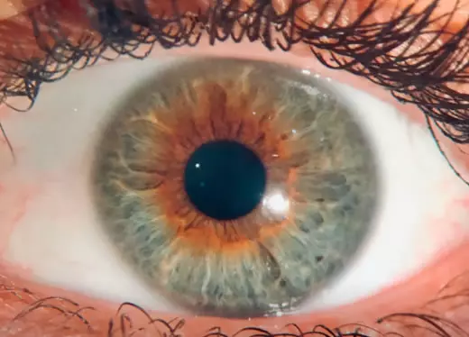 banner módulo neuroftalmologia