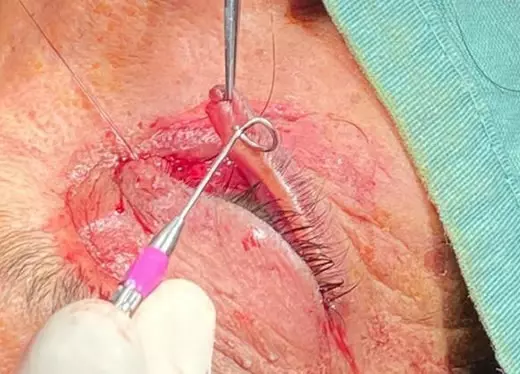 banner módulo plástica