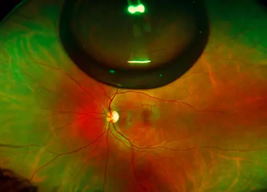 banner módulo retina