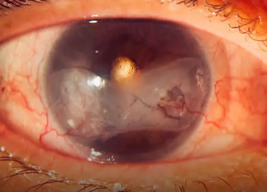 banner módulo uveíte